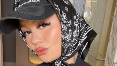 Agnez Mo Alami Kebotakan akibat Mengidap Alopecia, Efek Stres