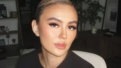 Mengenal Alopecia Areata, Penyakit yang dimaksud yang dimaksud Menjangkit Agnez Mo hingga Alami Kebotakan
